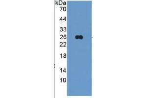WB of Protein Standard: different control antibodies  against Highly purified E. (TIE1 Kit ELISA)