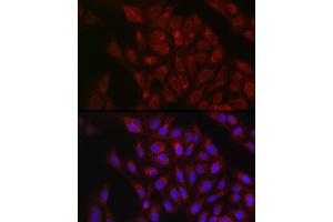 Immunofluorescence analysis of U2OS cells using RBCK1 antibody (ABIN7269848) at dilution of 1:100.