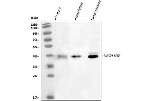 Western blot analysis of HSD11B2 using anti-HSD11B2 antibody (ABIN3043846). (HSD11B2 anticorps  (C-Term))