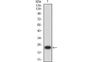 Western blot analysis using HIF2a mAb against human HIF2a (AA: 680-870) recombinant protein. (EPAS1 anticorps  (AA 680-870))