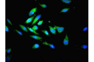 Immunofluorescent analysis of Hela cells using ABIN7164986 at dilution of 1:100 and Alexa Fluor 488-congugated AffiniPure Goat Anti-Rabbit IgG(H+L)