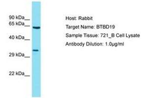 Image no. 1 for anti-BTB (POZ) Domain Containing 19 (BTBD19) (AA 208-257) antibody (ABIN6750766) (BTBD19 anticorps  (AA 208-257))