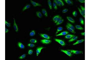Immunofluorescent analysis of Hela cells using ABIN7160982 at dilution of 1:100 and Alexa Fluor 488-congugated AffiniPure Goat Anti-Rabbit IgG(H+L)