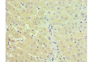 Immunohistochemistry of paraffin-embedded human liver tissue using ABIN7170690 at dilution of 1:100