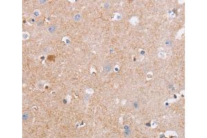 Immunohistochemistry (IHC) image for anti-Cell Division Cycle 7 (CDC7) antibody (ABIN2434442) (CDC7 anticorps)