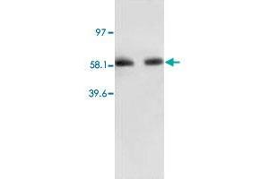 Western Blot analysis of RELA expression from human colon carcinoma lyate with RELA polyclonal antibody . (NF-kB p65 anticorps  (N-Term))