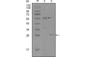 Western blot analysis using PGR mouse mAb against truncated MBP-PGR recombinant protein (1) and truncated Trx-PGR(aa730-871) recombinant protein (2).