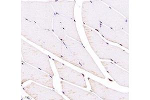 Immunohistochemistry of paraffin embedded rat Skeletal muscle using Troponin I (ABIN7076031) at dilution of 1:700 (400x lens)