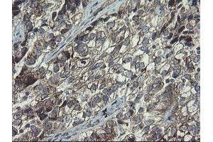 Image no. 9 for anti-Polymerase (RNA) III (DNA Directed) Polypeptide C (62kD) (POLR3C) antibody (ABIN1500340)