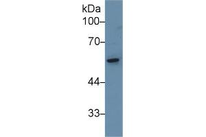 Western Blot; Sample: Rat Small intestine lysate; Primary Ab: 1µg/ml Rabbit Anti-Rat KRT8 Antibody Second Ab: 0. (CAP1 anticorps  (AA 38-149))