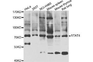 Western blot analysis of extracts of various cell lines, using STAT4 antibody.