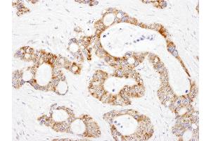 Immunohistochemistry (IHC) image for anti-Dihydrolipoamide S-Succinyltransferase (E2 Component of 2-Oxo-Glutarate Complex) (DLST) (AA 50-100) antibody (ABIN7455019) (DLST anticorps  (AA 50-100))
