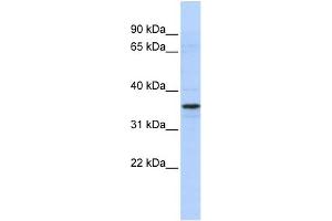 WB Suggested Anti-TADA2L Antibody Titration:  0. (TADA2L anticorps  (N-Term))