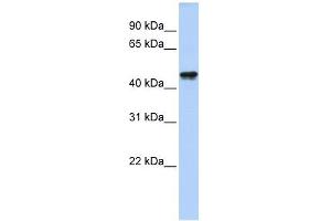 QTRTD1 antibody used at 1 ug/ml to detect target protein. (QTRTD1 anticorps  (N-Term))