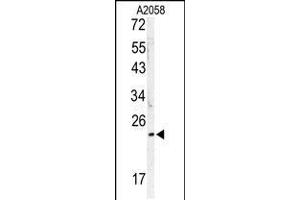 Western blot analysis of MOBKL1B antibody in A2058 cell line lysates (35ug/lane) (MOB1A anticorps  (C-Term))