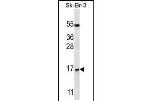 Western blot analysis in SK-BR-3 cell line lysates (35ug/lane).