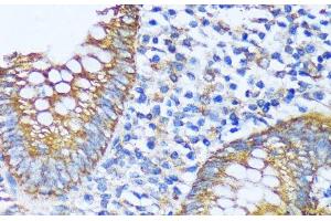 Immunohistochemistry of paraffin-embedded Human appendix using ACOT2 Polyclonal Antibody at dilution of 1:100 (40x lens). (ACOT2 anticorps)