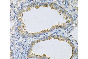 Immunohistochemistry of paraffin-embedded Mouse lung using AP2B1 Polyclonal Antibody at dilution of 1:100 (40x lens). (AP2B1 anticorps)