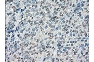 Image no. 1 for anti-Fc gamma RII (CD32) antibody (ABIN1497254) (Fc gamma RII (CD32) anticorps)