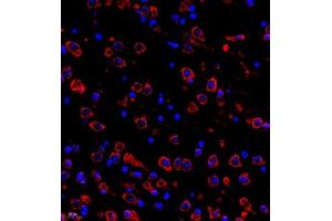 Immunofluorescence (IF) image for anti-Chloride Intracellular Channel 6 (CLIC6) antibody (ABIN7073478)