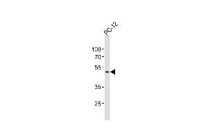 Anti-PIP4K2A Antibody (C-term)at 1:1000 dilution + PC-12 whole cell lysates Lysates/proteins at 20 μg per lane. (PIP4K2A anticorps  (C-Term))