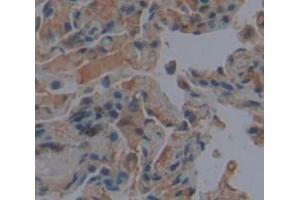 IHC-P analysis of Human Tissue, with DAB staining. (KPNA1 anticorps  (AA 239-506))