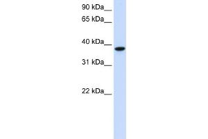 WB Suggested Anti-GLT8D2 Antibody Titration:  0. (GLT8D2 anticorps  (C-Term))