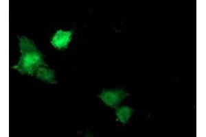Image no. 4 for anti-Signal Transducer and Activator of Transcription 5A (STAT5A) antibody (ABIN1501190)