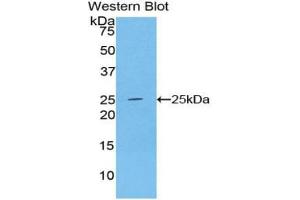 Western blot analysis of the recombinant protein. (ADH1 anticorps  (AA 169-370))
