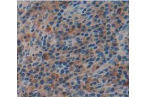 IHC-P analysis of Human Tissue, with DAB staining.