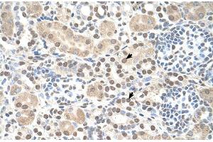 anti-ST8 alpha-N-Acetyl-Neuraminide alpha-2,8-Sialyltransferase 2 (ST8SIA2) (C-Term) antibody