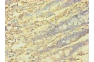 anti-Protein Interacting With Protein Kinase C, alpha 1 (PICK1) (AA 1-200) antibody