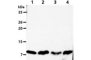 The Cell lysates (40ug) were resolved by SDS-PAGE, transferred to PVDF membrane and probed with anti-human DYNLL antibody (1:1000). (DYNLL1 anticorps)