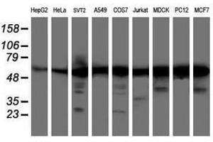 Image no. 1 for anti-V-Akt Murine Thymoma Viral Oncogene Homolog 1 (AKT1) antibody (ABIN1496558) (AKT1 anticorps)