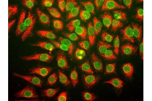 HeLa cells were stained with anti-nuclear pore complex antibody (green), and chicken anti-vimentin (red). (Nuclear Stain of Multiple Gene Products Including Nup62, Nup133 anticorps)