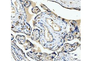IHC analysis of CD163 using anti-CD163 antibody (ABIN5693082).