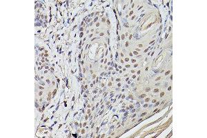 Immunohistochemistry of paraffin-embedded Human skin using Pea3 / ETV4 antibody (ABIN6131217, ABIN6140332, ABIN6140334 and ABIN6221480) at dilution of 1:100 (40x lens).