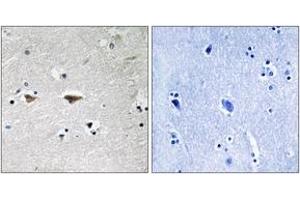 Immunohistochemistry analysis of paraffin-embedded human brain tissue, using Src (Ab-75) Antibody. (Src anticorps  (AA 41-90))