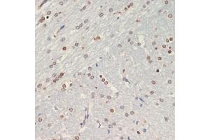 Immunohistochemistry of paraffin-embedded rat brain using Olig2 antibody (ABIN6128396, ABIN6145015, ABIN6145016 and ABIN6216575) at dilution of 1:200 (40x lens).