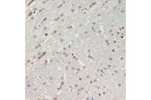 Immunohistochemistry of paraffin-embedded rat brain using Olig2 antibody (ABIN6128396, ABIN6145015, ABIN6145016 and ABIN6216575) at dilution of 1:200 (40x lens). (OLIG2 anticorps  (AA 1-80))