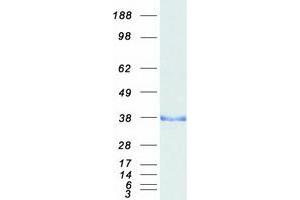 Validation with Western Blot
