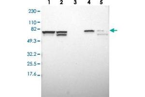 Western blot analysis of Lane 1: RT-4, Lane 2: U-251 MG, Lane 3: Human Plasma, Lane 4: Liver, Lane 5: Tonsil with SETD3 polyclonal antibody  at 1:250-1:500 dilution. (SETD3 anticorps)
