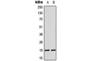 Western blot analysis of LATH expression in DU145 (A), K562 (B) whole cell lysates. (LATH anticorps  (Center))