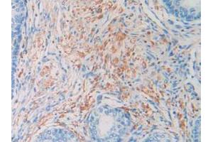IHC-P analysis of Human Prostate Gland Tissue, with DAB staining. (HIST1H2AG anticorps  (AA 1-130))