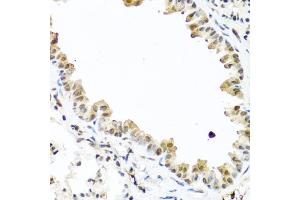 Immunohistochemistry of paraffin-embedded mouse lung using TET2 antibody (ABIN6133019, ABIN6149017, ABIN6149019 and ABIN6221336) at dilution of 1:100 (40x lens).