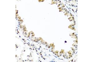 Immunohistochemistry of paraffin-embedded mouse lung using TET2 antibody (ABIN6133019, ABIN6149017, ABIN6149019 and ABIN6221336) at dilution of 1:100 (40x lens). (TET2 anticorps  (AA 1833-2002))