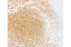 Immunohistochemistry (IHC) image for anti-Nuclear Factor-kB p65 (NFkBP65) (C-Term) antibody (ABIN7795800)