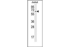 Image no. 1 for anti-SUMO1 Activating Enzyme Subunit 2 (UBA2) (C-Term) antibody (ABIN356597)