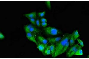 Immunofluorescent analysis of Hela cells using ABIN7168489 at dilution of 1:100 and Alexa Fluor 488-congugated AffiniPure Goat Anti-Rabbit IgG(H+L)