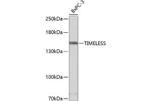 anti-Timeless Homolog (TIMELESS) (AA 969-1208) antibody
